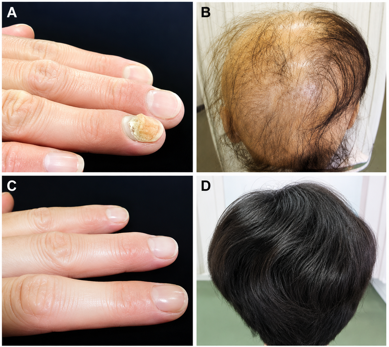 Hair and nail treatment consultation